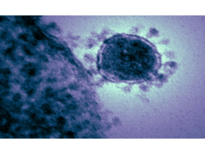 Canada xác nhận bệnh nhân đầu tiên nhiễm virus corona 